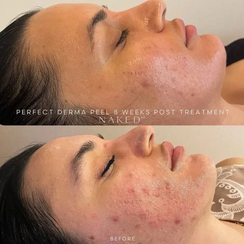 NakedMD Rancho Cucamonga — Medical spa in Rancho Cucamonga